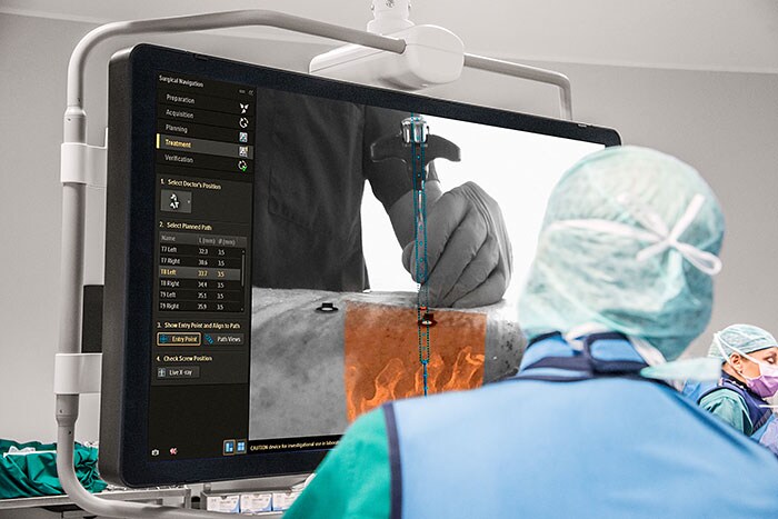 Philips Surgical Navigation Technology based on Augmented Reality (Ouvre dans une nouvelle fenêtre)