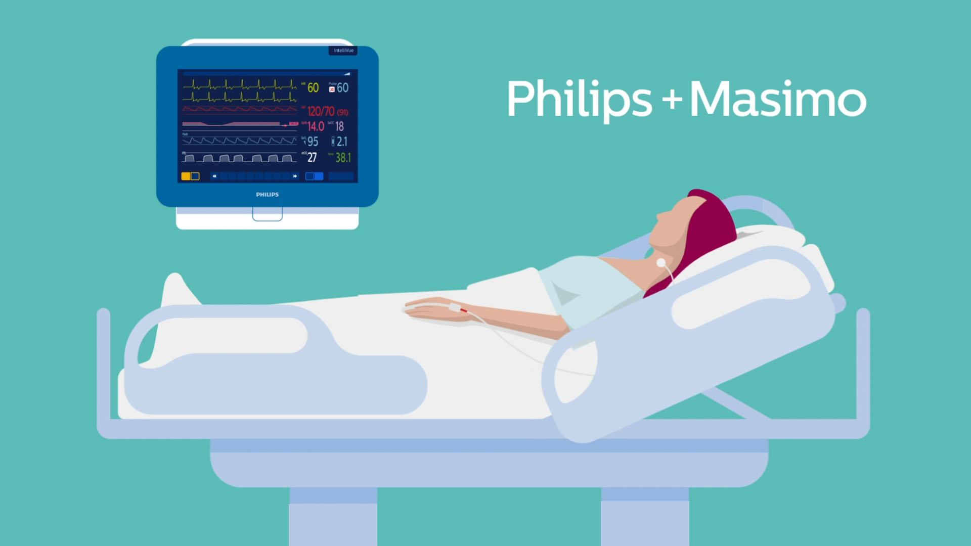 Animation Philips / Masimo