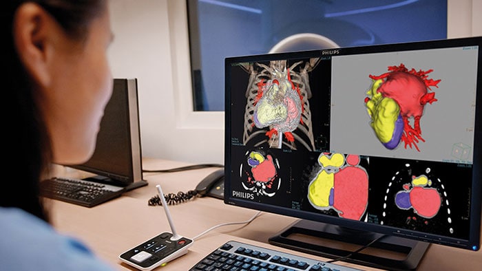 Artsen analyseren patiëntgegevens aan de hand van geavanceerde beeldvisualisatie