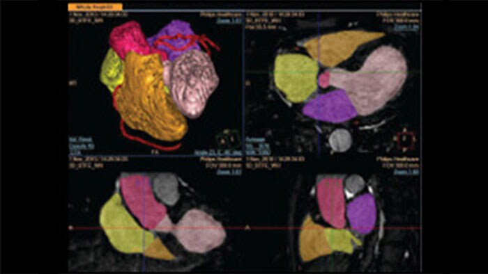 Gedetailleerde scanbeelden van het hart in 3D