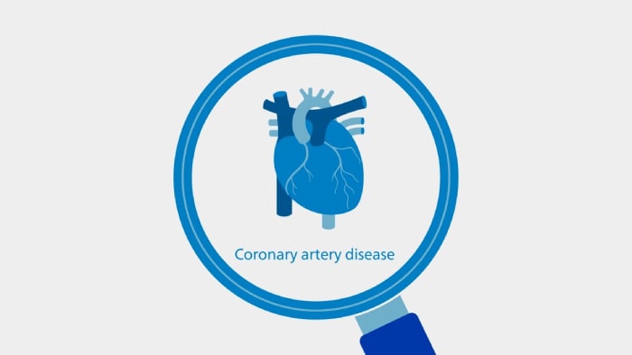 Geïntegreerde oplossingen in het gehele zorgtraject voor coronaire hartziekten