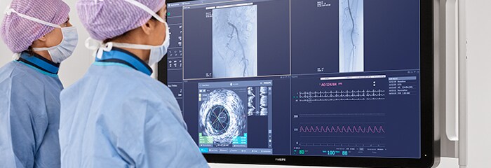 Pop-up CAD-behandeling ivus