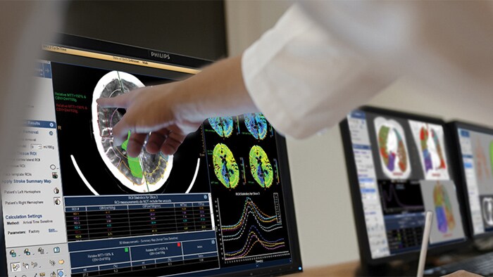 Solutions Philips pour le workflow en Radiologie