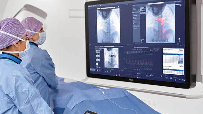 Interventies bij aangeboren hartafwijkingen