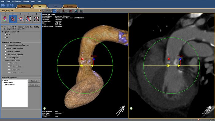 HeartNavigator Outils cliniques et options disponibles