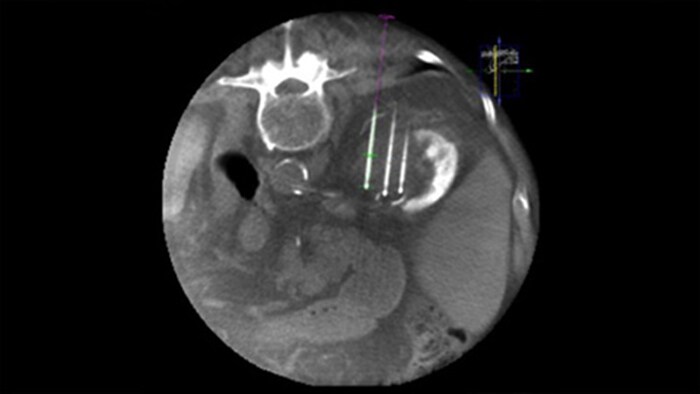 3D CBCT avec double affichage