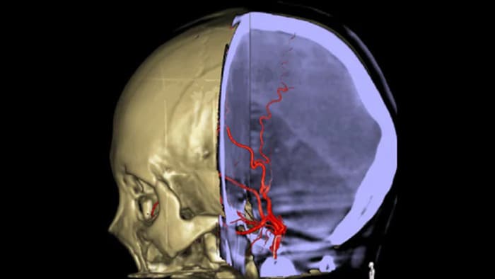 Anatomische referenties ondersteunen nauwkeurige navigatie