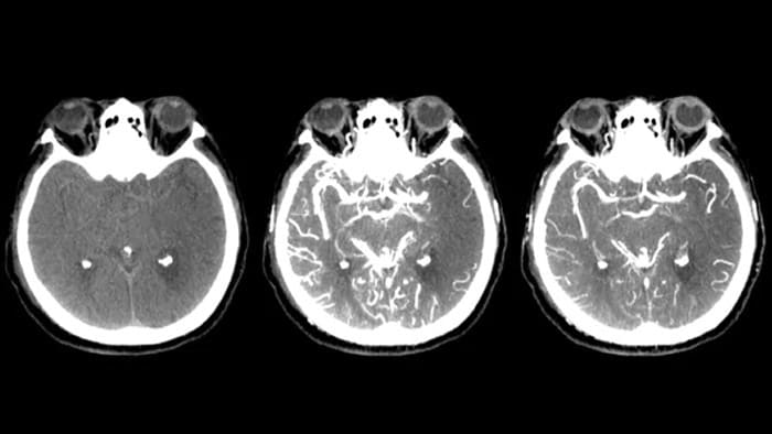 CT achtige visualisatie