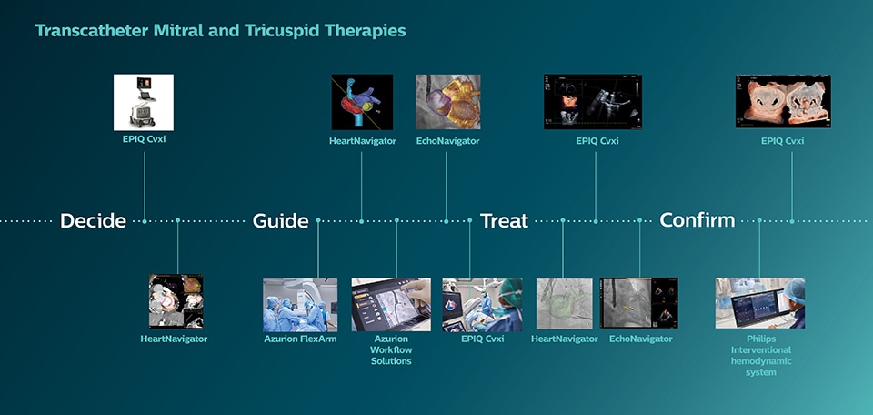 Traitements transcathéter des valves mitrale et tricuspide