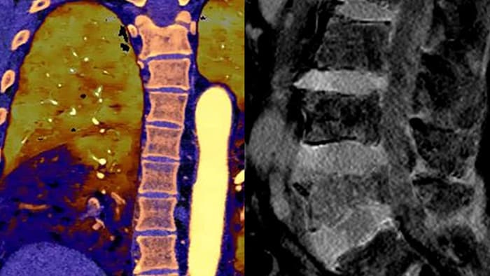 Beeld spectrale CT