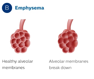 Membranes alvéolaires