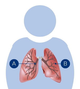 Coupe transversale du poumon