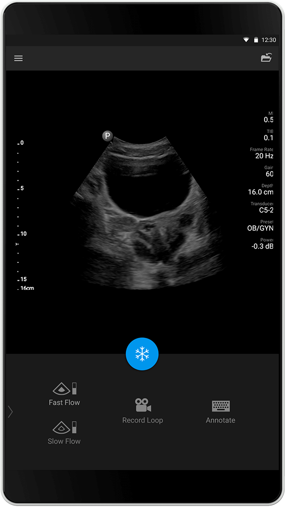 OB/GYN-onderzoek C5-2