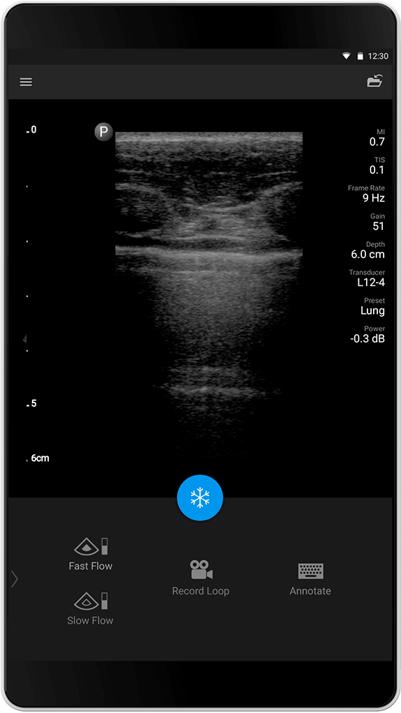 Examen pulmonaire