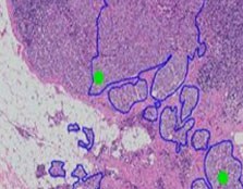 Aider les pathologistes à faire des diagnostics plus rapides et plus précis