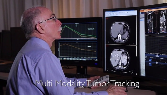 application Multi Modality Tumor Tracking sur IntelliSpace Portal