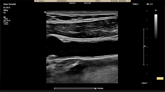 epiq 7-echografiesysteem