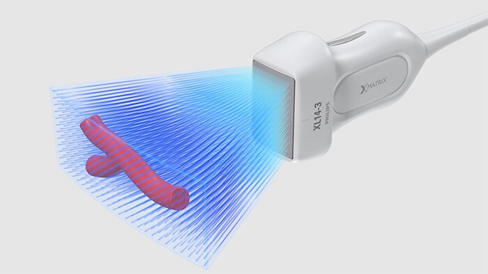 3D-/4D-resolutie van hoge kwaliteit