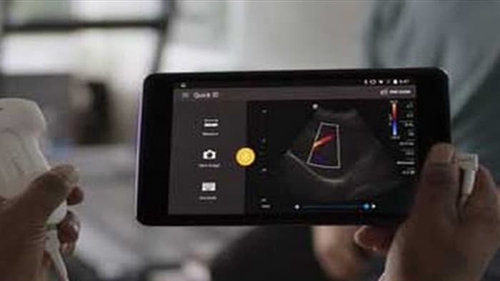 Philips Lumify - Ultrasound on your compatible smart device