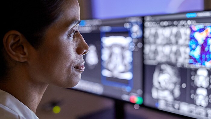 Tijd terugwinnen bij radiologie: hoe AI kan helpen personeels- en zorgtekorten terug te dringen door middel van gestroomlijnde workflows