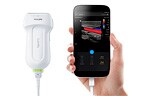 Special Lumify Ultra-Mobile Ultrasound Solution