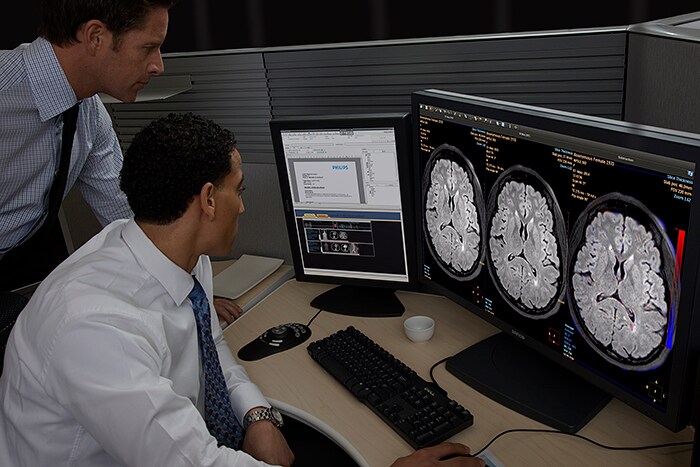 IntelliSpace Portal offers Longitudinal Brain Imaging (LoBI), an application that has been optimized for the interpretation of brain MRI scan and aims to facilitate the longitudinal evaluation of neurological disorders helping clinicians to monitor disease progression. (Ouvre dans une nouvelle fenêtre)