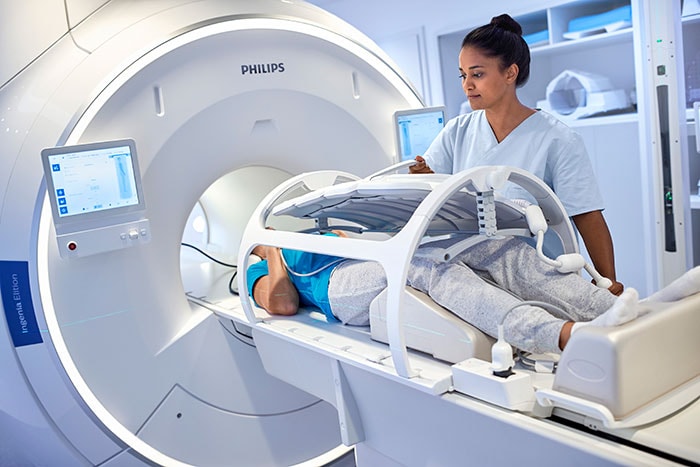 Le Big Bore RT de Philips est un système CT conçu pour une planification de traitement précise.
