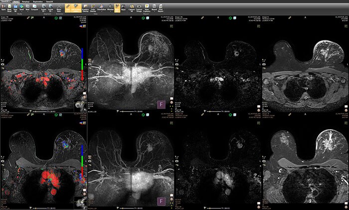 DynaCAD Breast Current Prior Layout