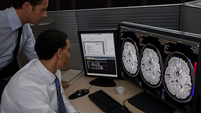 Le IntelliSpace Portal de Philips désigné chef de file des systèmes de visualisation avancée par KLAS pour l'année 2018