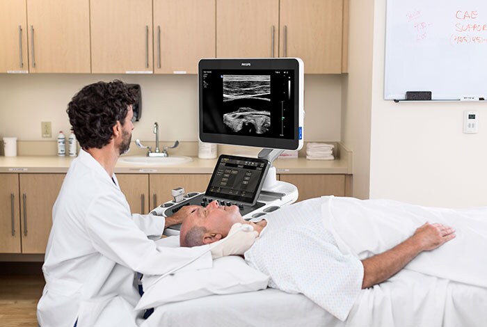 The Philips EPIQ Elite ultrasound system.