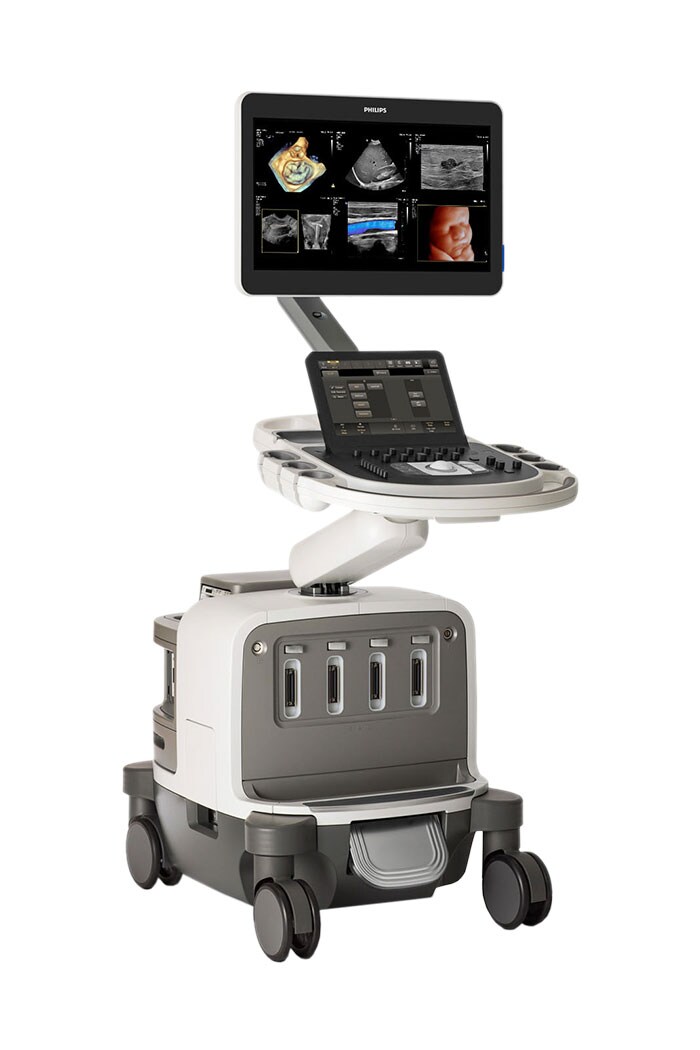 Philips EPIQ Elite ultrasound system