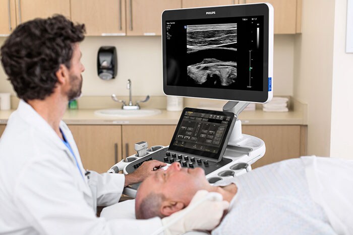 Philips Ultimate Solution for Vascular Assessment
