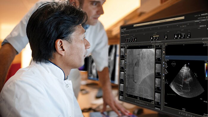 Philips lance à l'ESC 2019 des innovations en matière d'échographie et d'informatique d'entreprise pour faire progresser les soins cardiaques