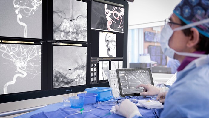 An interventional physician assesses a stroke patient on the Philips Azurion image-guided therapy platform