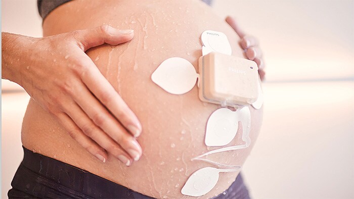 The Avalon Fetal and Maternal Pod and Patch is a single-use, disposable patch placed on the mother’s abdomen to capture fetal and maternal vitals without the need for constant repositioning