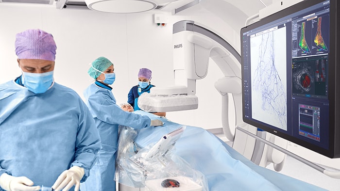 Philips intravascular ultrasound (IVUS) imaging (opent in een nieuw tabblad)