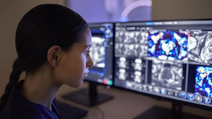 Philips présente de nouvelles solutions améliorées de flux de travail de radiologie et des systèmes d'imagerie intelligents connectés et évolutifs au congrès RSNA 2021