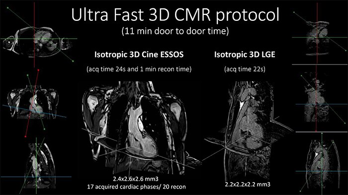 Ultra-fast 3C CMR protocoll