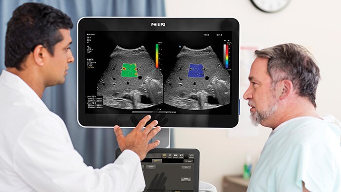 Philips étoffe sa gamme d'échographes de manière à accroître la fiabilité des diagnostics et l'efficacité des flux de travail