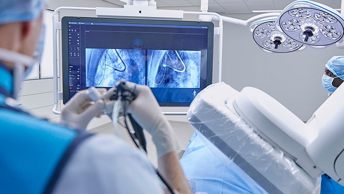 Twee ziekenhuizen in België nemen innovatieve technologie van Philips in gebruik voor de diagnose en behandeling van longkanker