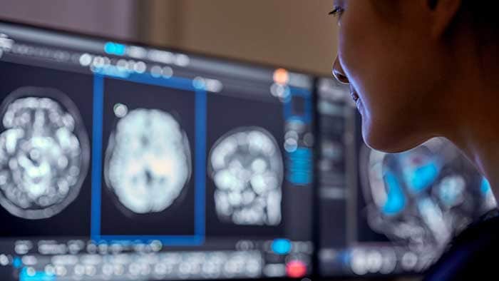 À l'occasion du #RSNA23, Philips dévoile de nouvelles innovations basées sur l'IA qui permettent aux professionnels de santé de se concentrer davantage sur les soins aux patients