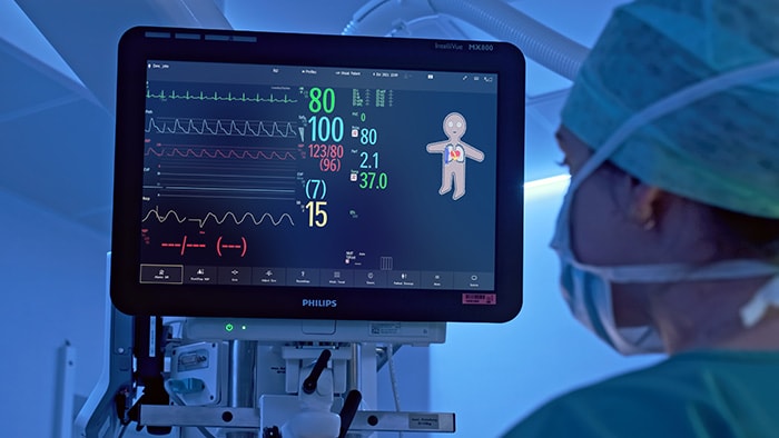 Philips Visual Patient Avatar helpt om met één blik patiëntgegevens te bekijken voor snellere en betere beslissingen in de operatiekamer