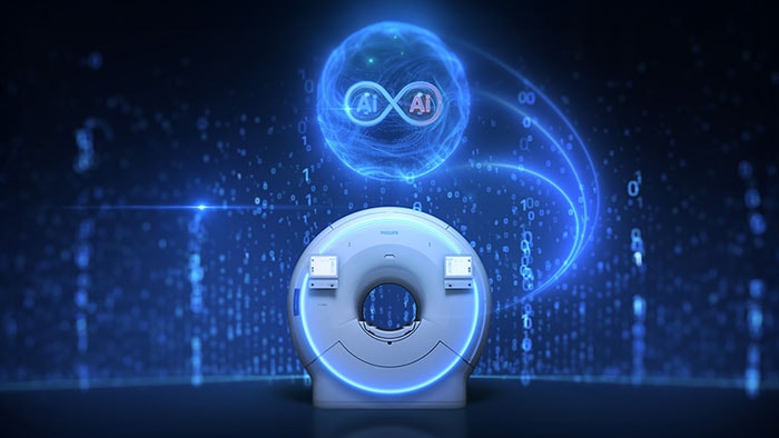 Philips versnelt nauwkeurige beeldvorming met unieke AI-technologieën bij MRI om patiëntresultaten te verbeteren