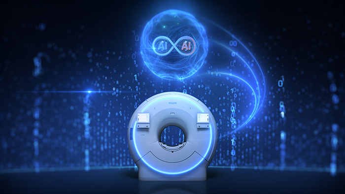 Dual AI engines in SmartSpeed Precise -  