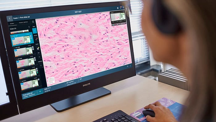 Philips breidt portfolio voor digitale pathologie uit met cloudgebaseerde Philips IntelliSite Pathology Solution op HealthSuite