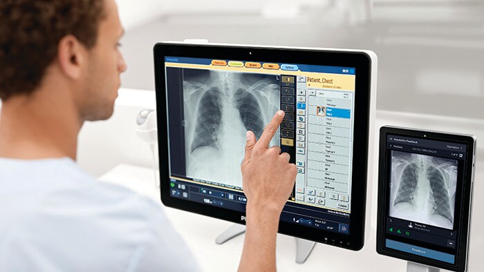 Philips lance son Radiology Smart Assistant basé sur l’IA sur Benelux pour améliorer l’acquisition d’images de radiographie
