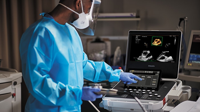 Philips presenteert Compact Ultrasound 5500CV met verbeterde AI toepassingen en maakt daarmee geavanceerde beeldvorming van het hart beschikbaar voor meer patiënten