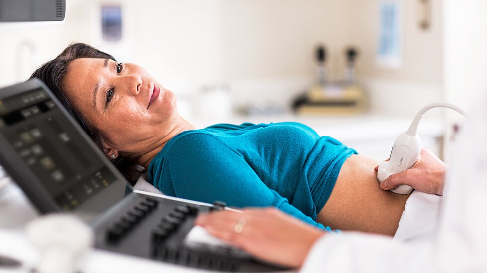Affiniti 800 – Philips Affiniti Ultrasound system
